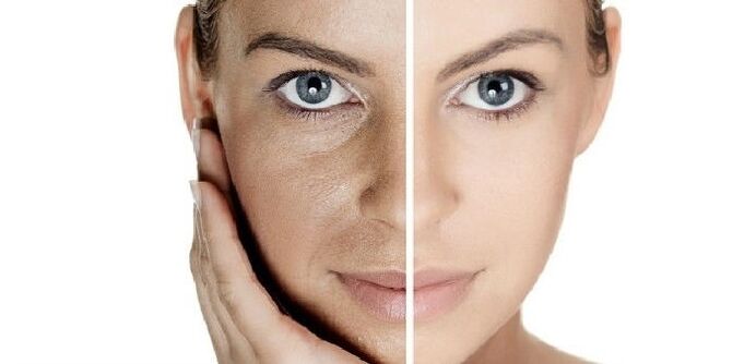 înainte și după întinerirea pielii feței