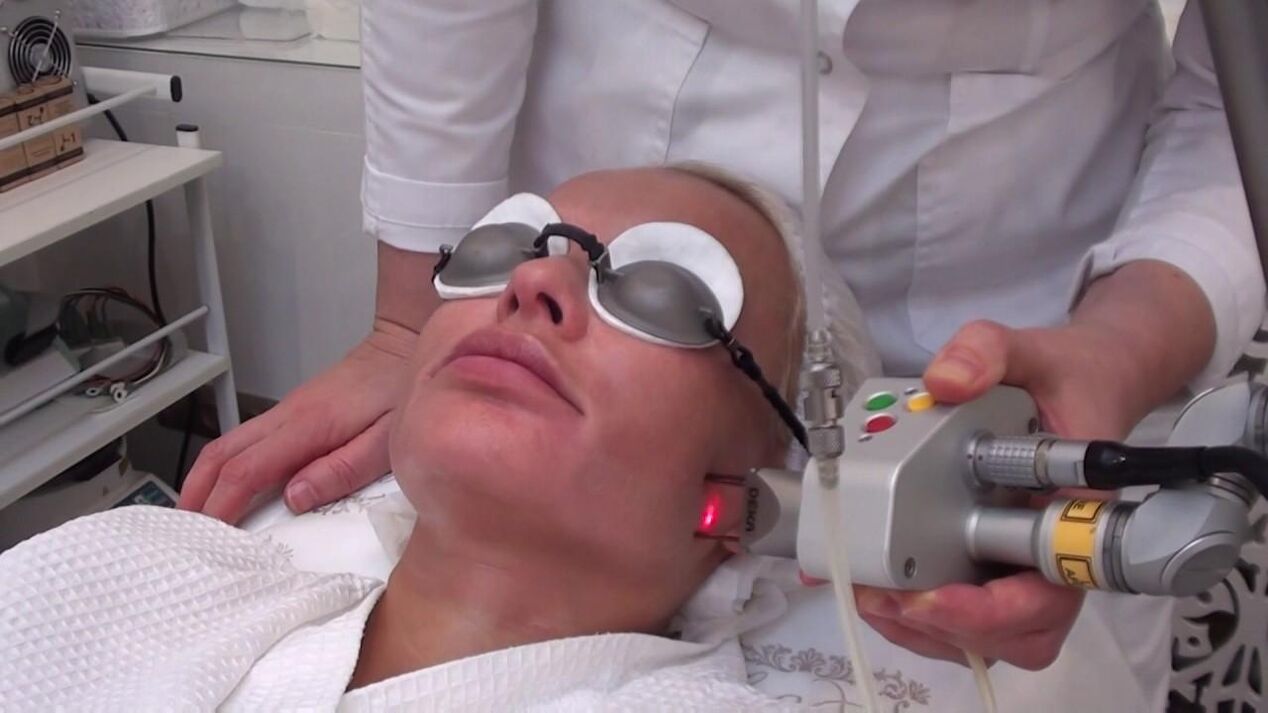 Tratamentul cu un fascicul laser al zonelor cu probleme ale pielii feței