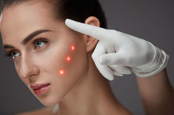 Întinerirea facială cu laser